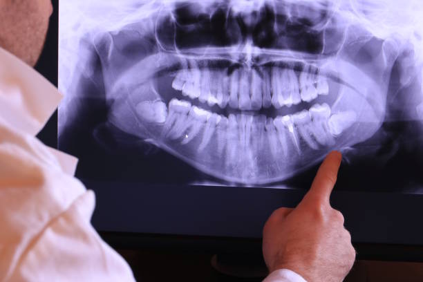 Best Walk-In Emergency Dentist in Kingstown, MD